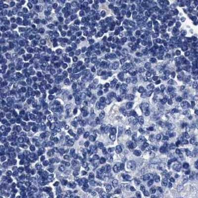 KLHL41 Antibody in Immunohistochemistry (IHC)