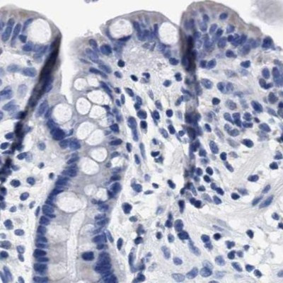 KLHL41 Antibody in Immunohistochemistry (IHC)