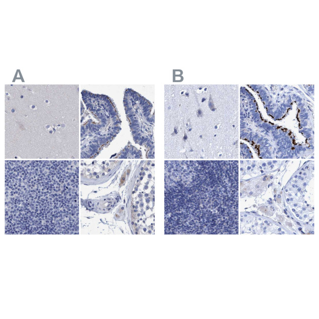 CROCC Antibody in Immunohistochemistry (IHC)