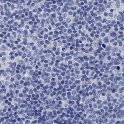 CROCC Antibody in Immunohistochemistry (IHC)