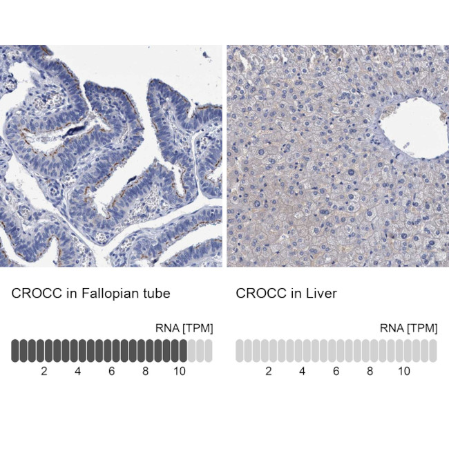 CROCC Antibody