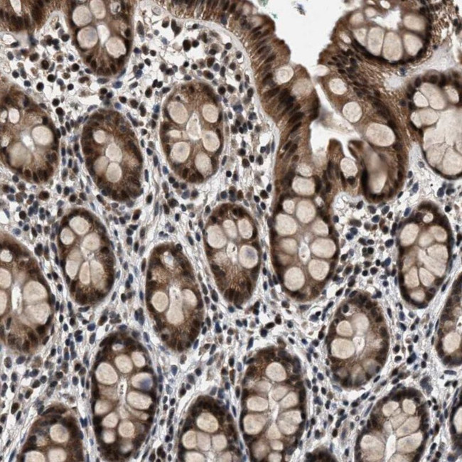 RBM33 Antibody in Immunohistochemistry (IHC)