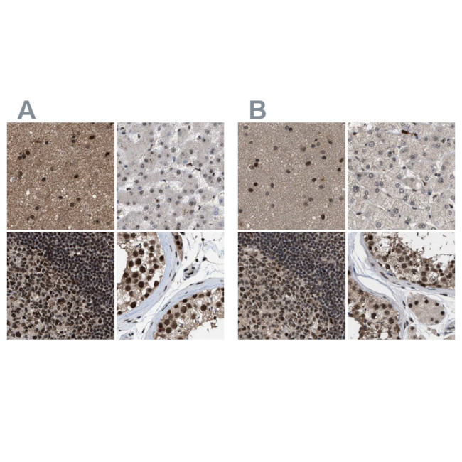 PRPF4 Antibody in Immunohistochemistry (IHC)