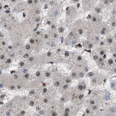 PRPF4 Antibody in Immunohistochemistry (IHC)