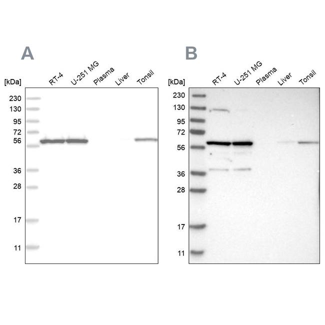 PRPF4 Antibody in Western Blot (WB)