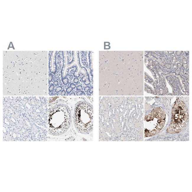 Actin-like 7B Antibody in Immunohistochemistry (IHC)