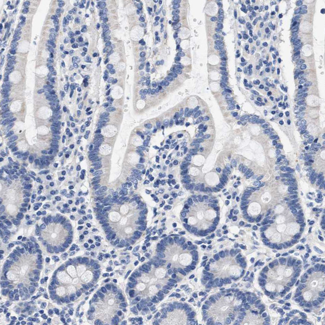 Actin-like 7B Antibody in Immunohistochemistry (IHC)