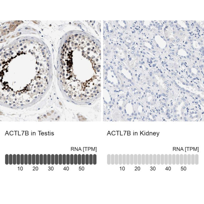 Actin-like 7B Antibody