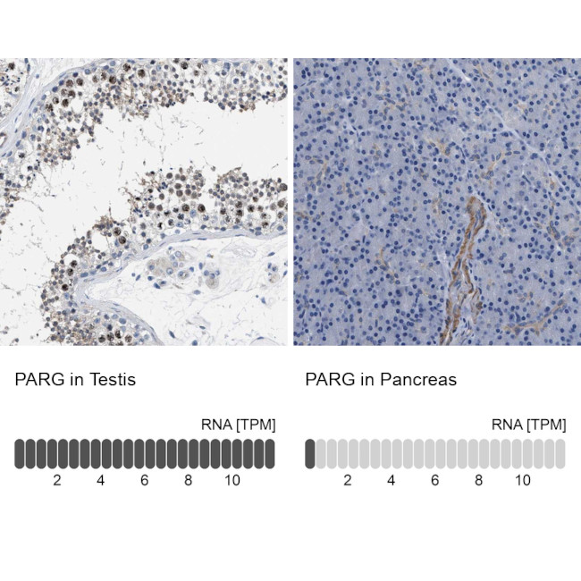 Parg Antibody in Immunohistochemistry (IHC)