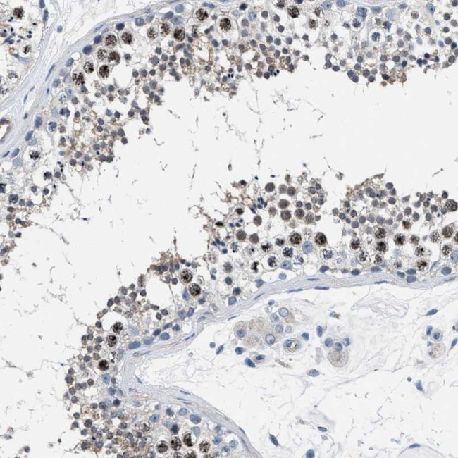 Parg Antibody in Immunohistochemistry (IHC)