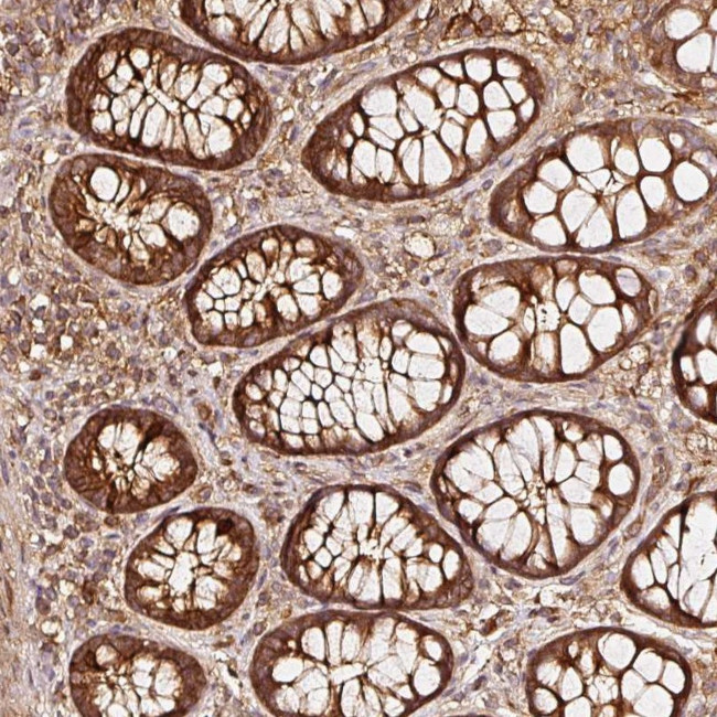 ASMTL Antibody in Immunohistochemistry (IHC)