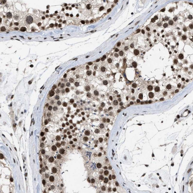 eIF4A3 Antibody in Immunohistochemistry (IHC)