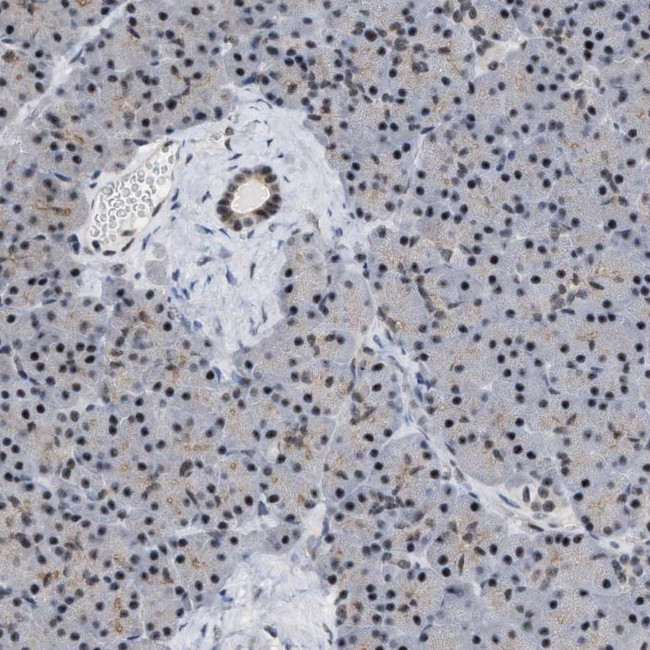 eIF4A3 Antibody in Immunohistochemistry (IHC)