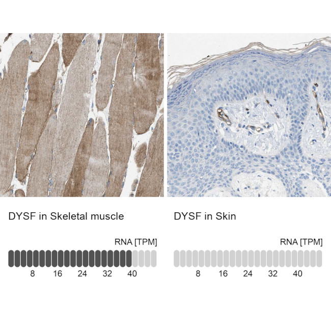 Dysferlin Antibody