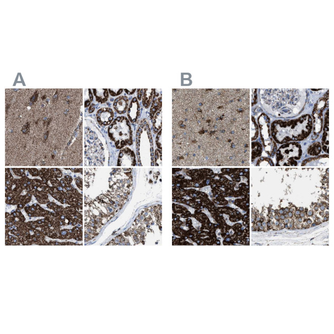 ECHS1 Antibody in Immunohistochemistry (IHC)