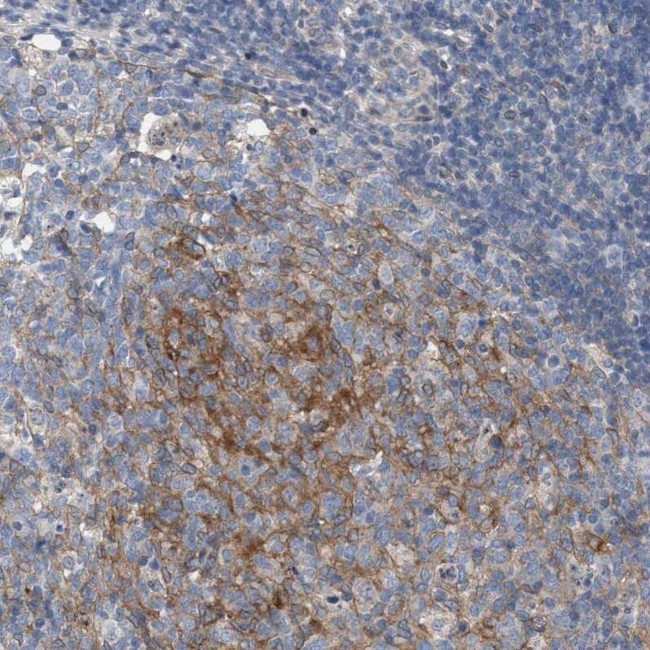 ARPC5L Antibody in Immunohistochemistry (IHC)