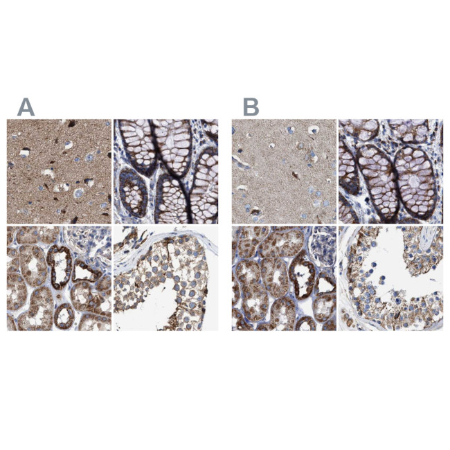 MECR Antibody in Immunohistochemistry (IHC)