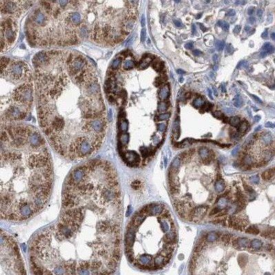 MECR Antibody in Immunohistochemistry (IHC)