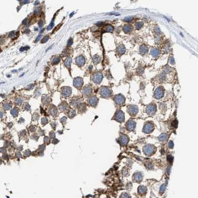 MECR Antibody in Immunohistochemistry (IHC)