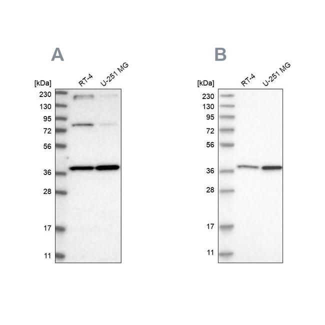 MECR Antibody in Western Blot (WB)