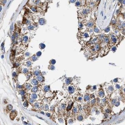 MECR Antibody in Immunohistochemistry (IHC)