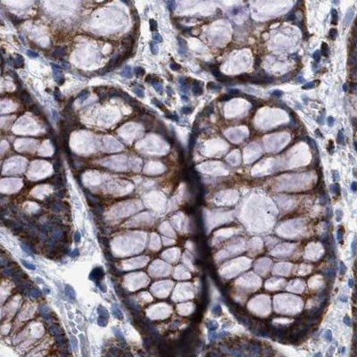 MECR Antibody in Immunohistochemistry (IHC)