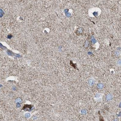 MECR Antibody in Immunohistochemistry (IHC)