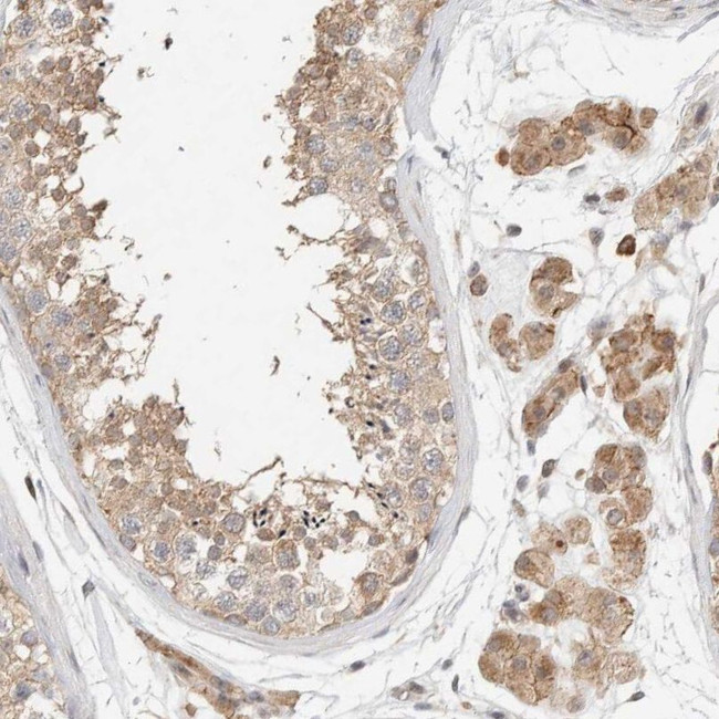 KIF9 Antibody in Immunohistochemistry (IHC)