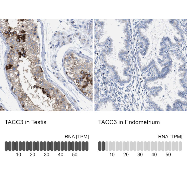 TACC3 Antibody in Immunohistochemistry (IHC)
