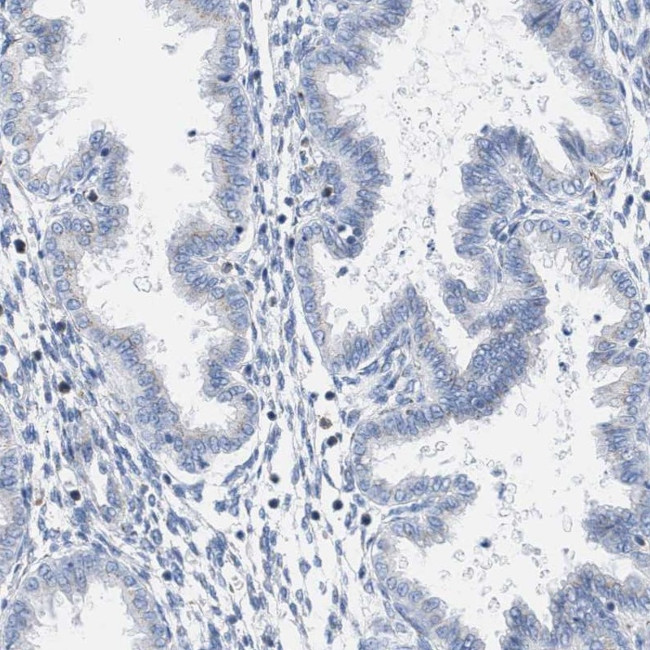 TACC3 Antibody in Immunohistochemistry (IHC)