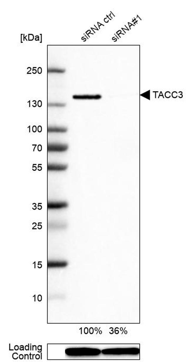 TACC3 Antibody in Western Blot (WB)