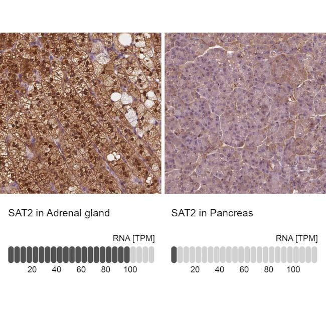 SAT2 Antibody in Immunohistochemistry (IHC)