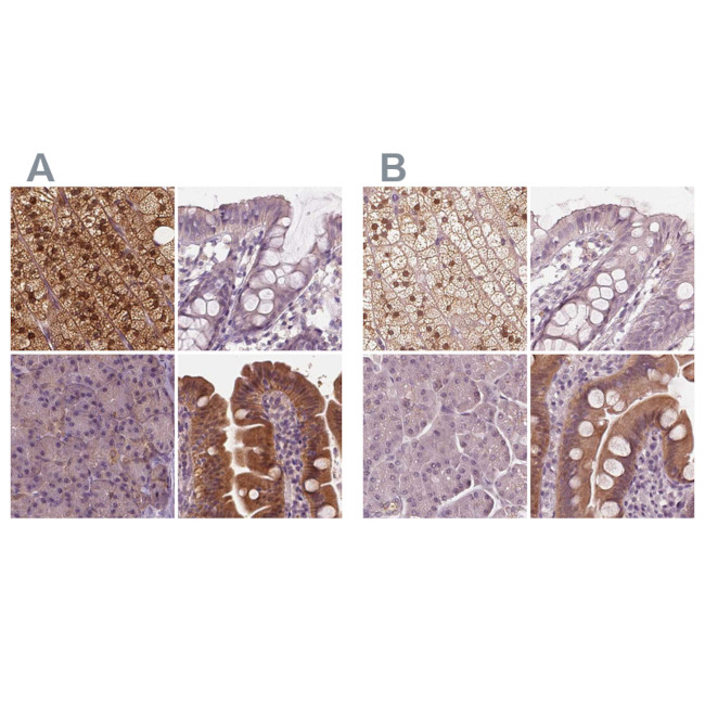 SAT2 Antibody in Immunohistochemistry (IHC)