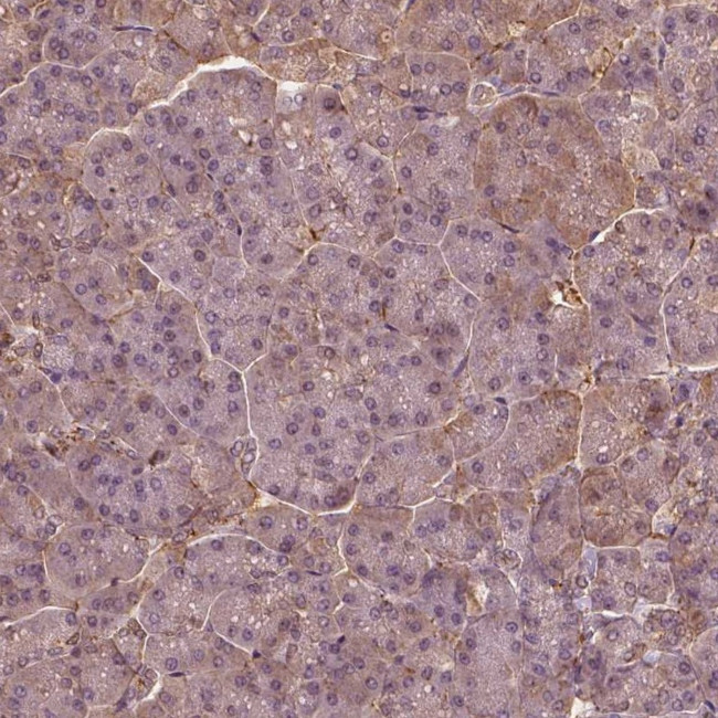 SAT2 Antibody in Immunohistochemistry (IHC)