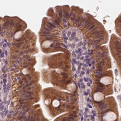 SAT2 Antibody in Immunohistochemistry (IHC)