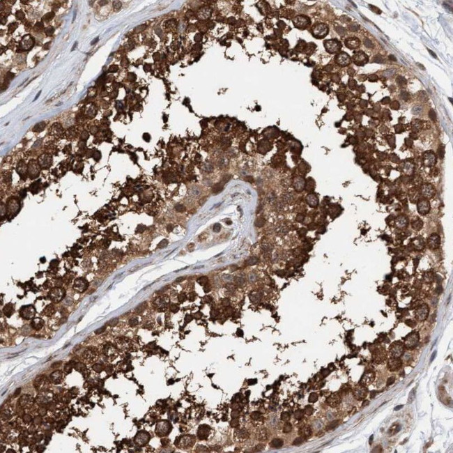 Synip Antibody in Immunohistochemistry (IHC)