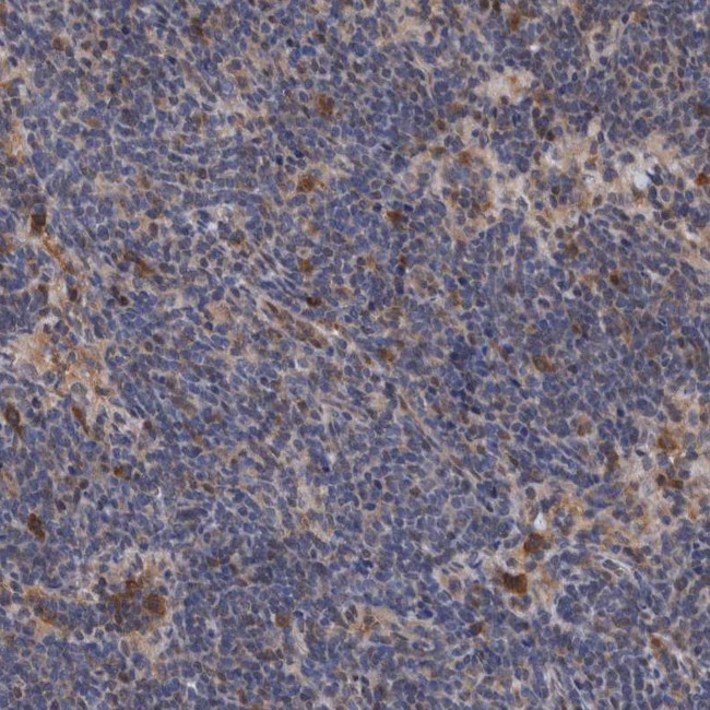 PFAS Antibody in Immunohistochemistry (IHC)