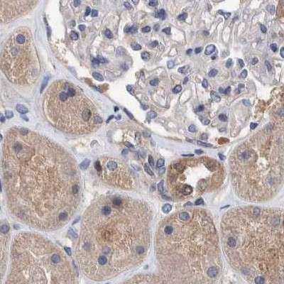 PFAS Antibody in Immunohistochemistry (IHC)