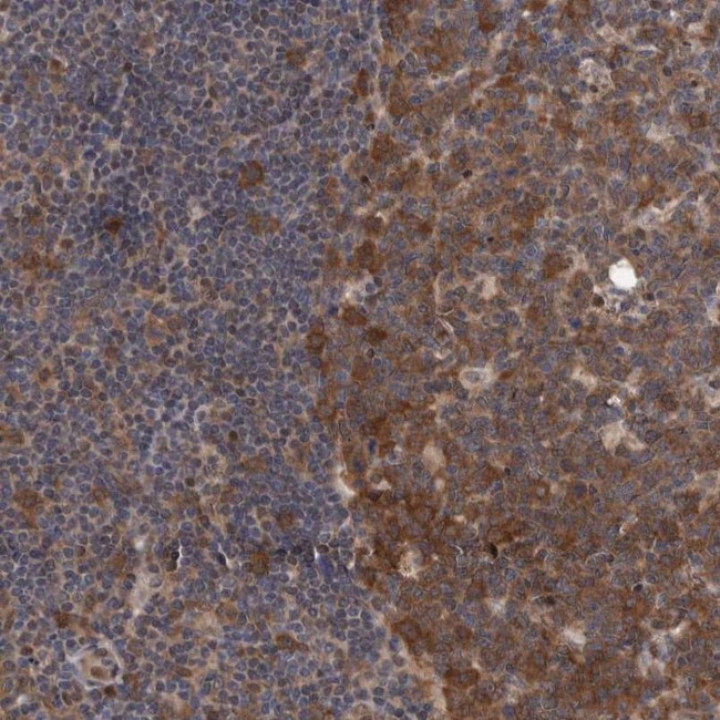 PFAS Antibody in Immunohistochemistry (IHC)