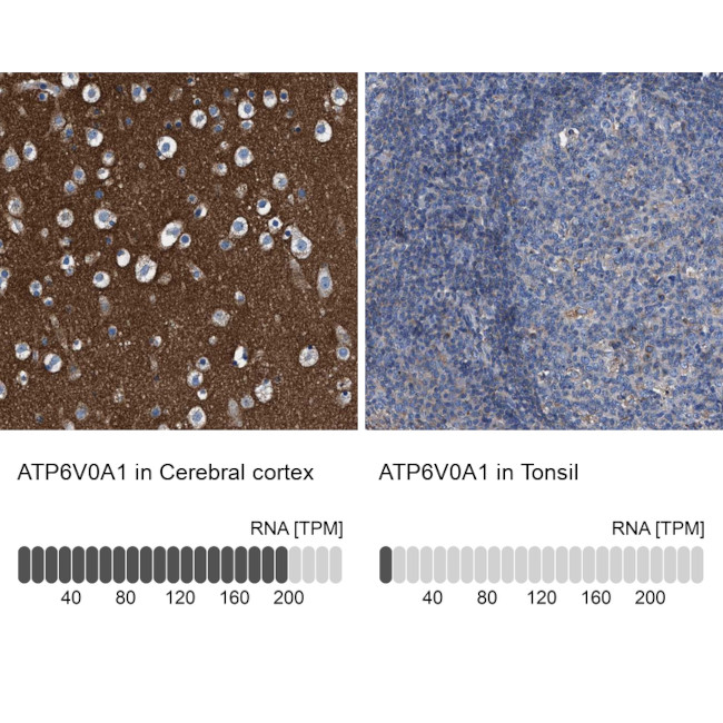 ATP6V0A1 Antibody in Immunohistochemistry (IHC)