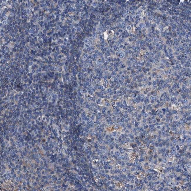 ATP6V0A1 Antibody in Immunohistochemistry (IHC)