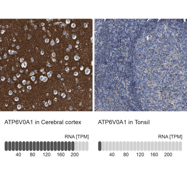 ATP6V0A1 Antibody