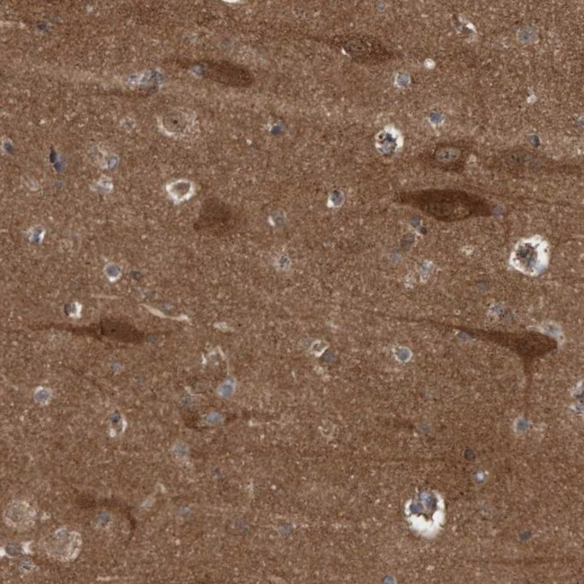 GARNL4 Antibody in Immunohistochemistry (IHC)