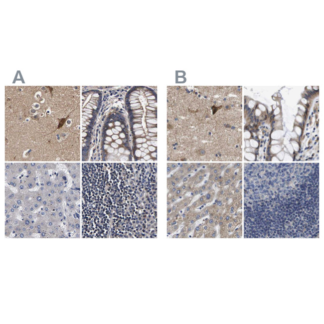 Axotrophin Antibody in Immunohistochemistry (IHC)