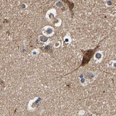 Axotrophin Antibody in Immunohistochemistry (IHC)