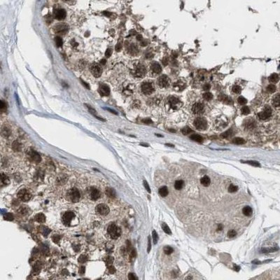 PRPF4 Antibody in Immunohistochemistry (IHC)