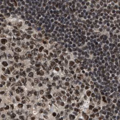 PRPF4 Antibody in Immunohistochemistry (IHC)