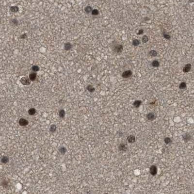 PRPF4 Antibody in Immunohistochemistry (IHC)