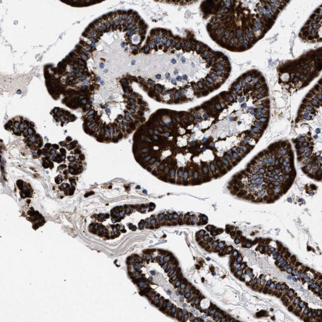 ACADS Antibody in Immunohistochemistry (IHC)