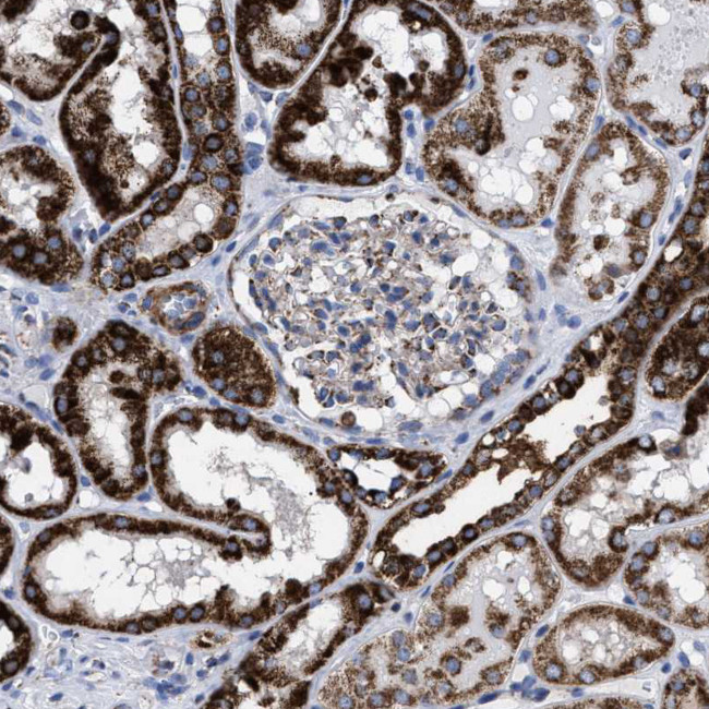 ACADS Antibody in Immunohistochemistry (IHC)